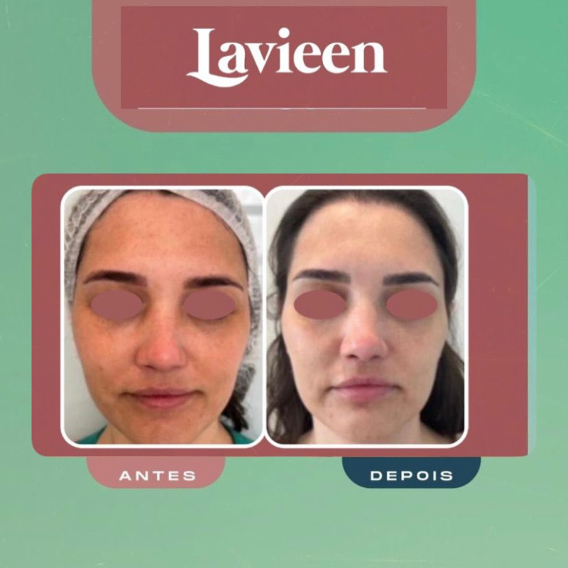 Lavieen