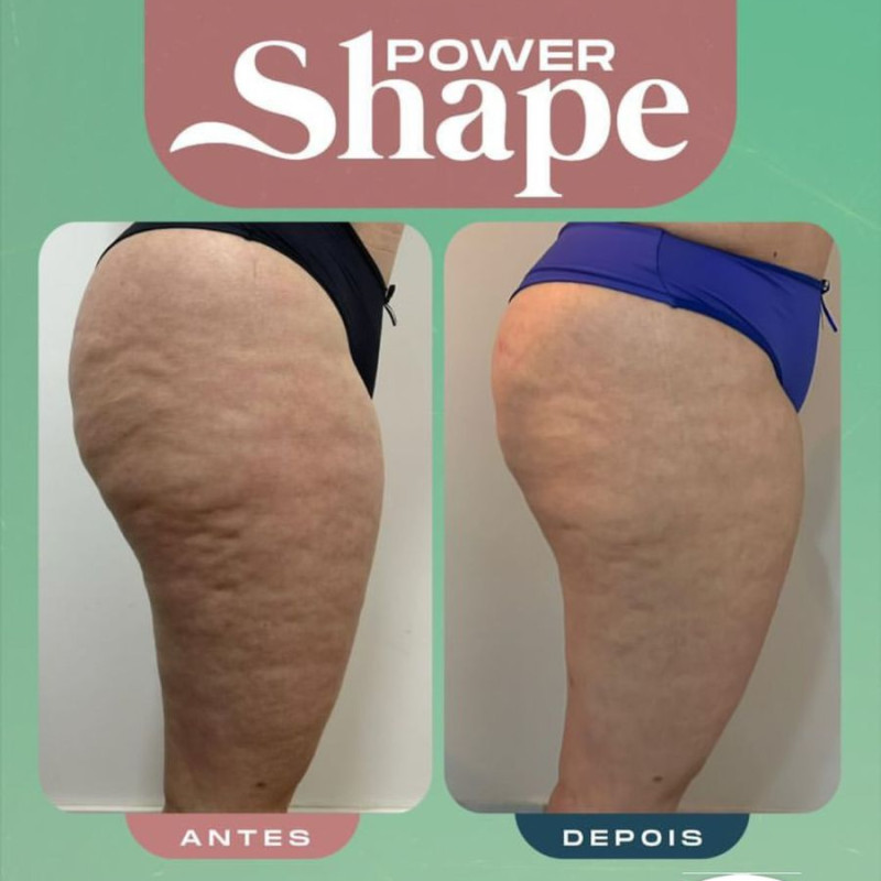 Power shape